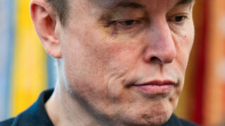 Mata Elon Musk Lebam Saat Pamitan ke Donald Trump